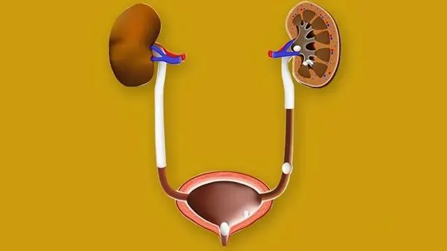 Các triệu chứng sỏi bàng quang và cách điều trị