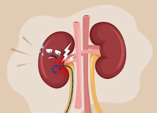 Cách giảm khó chịu sau khi đặt stent niệu quản