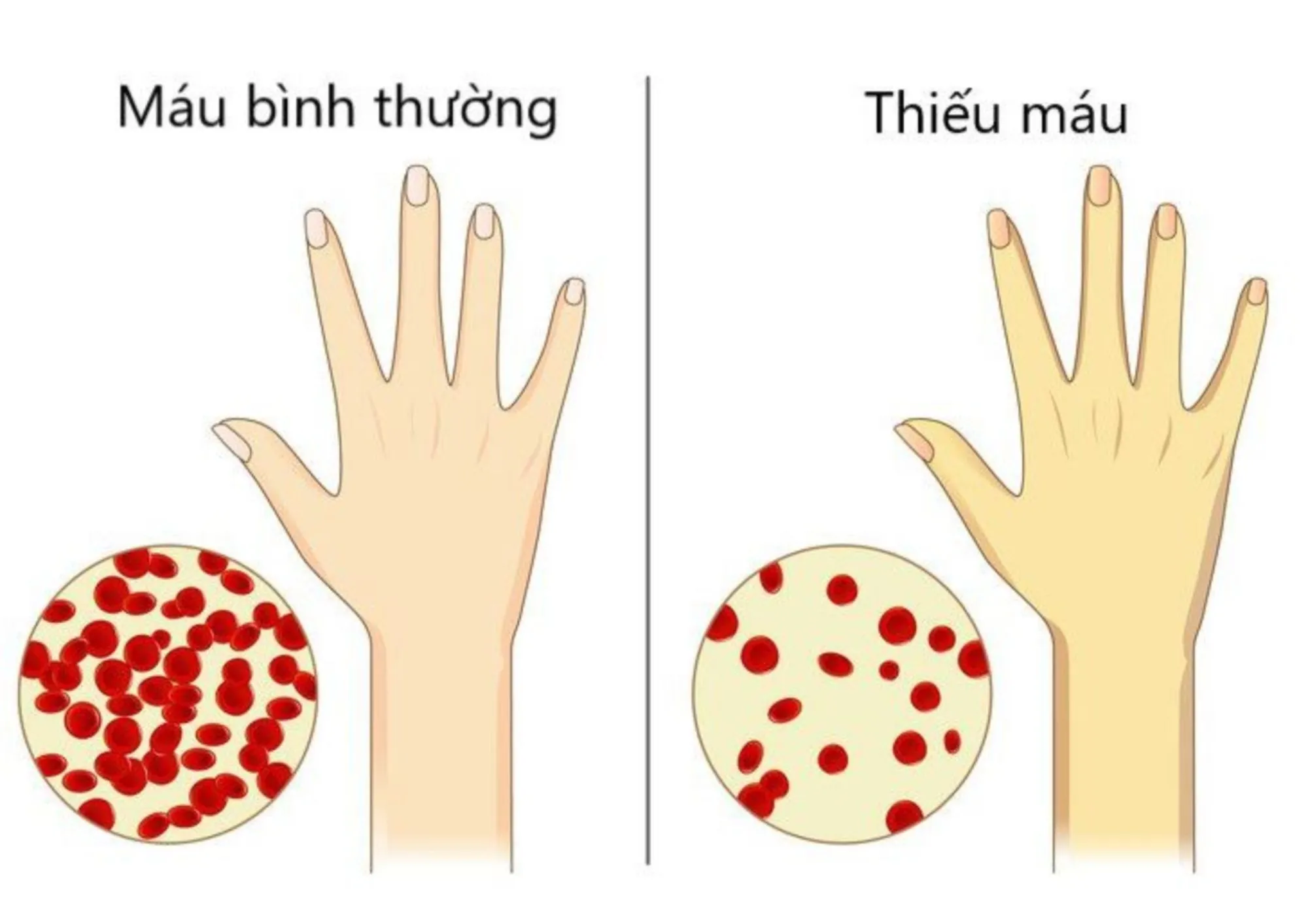 thieu mau 1