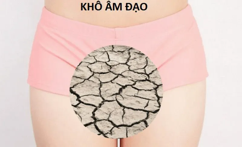 Những nguyên nhân gây khô âm đạo