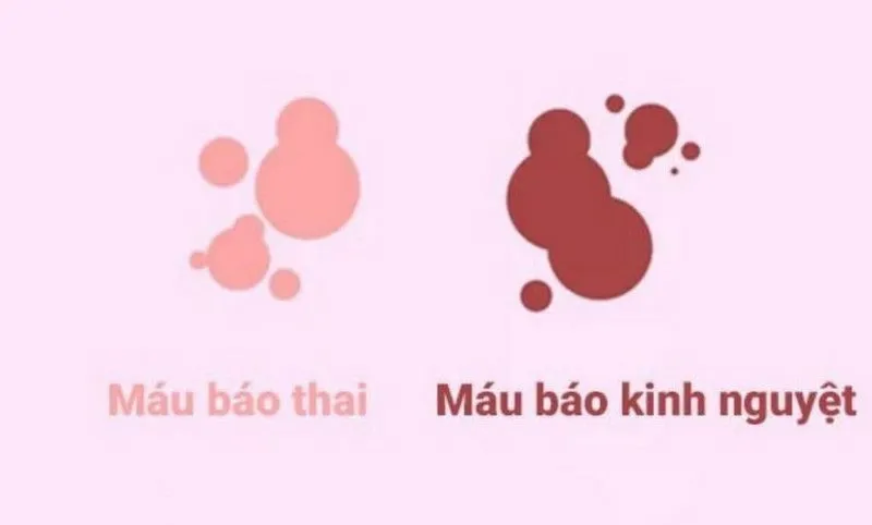 Phân biệt kinh nguyệt sớm và sảy thai