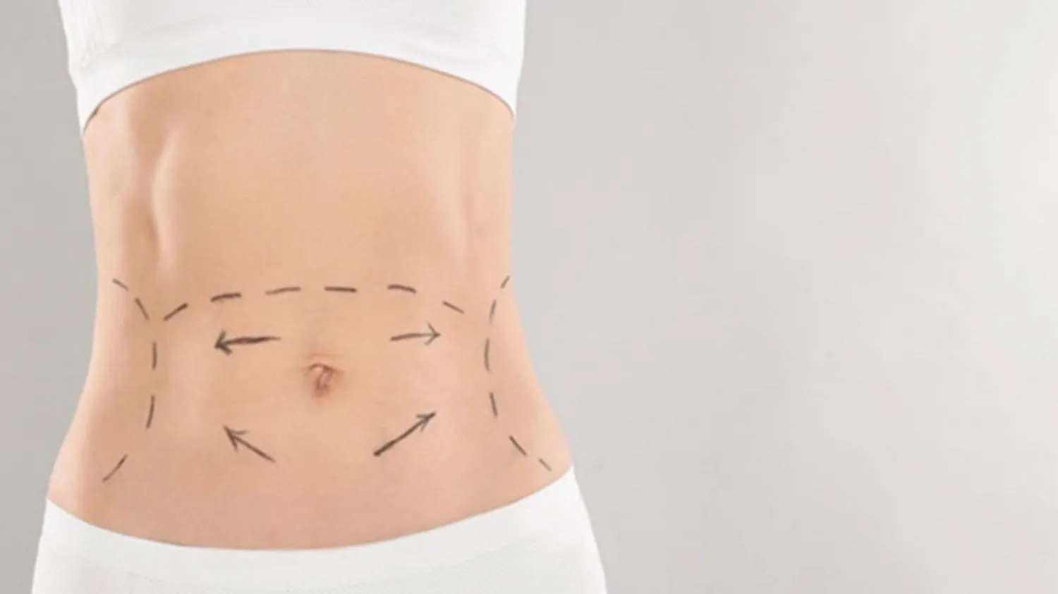 Những rủi ro khi giảm mỡ bằng công nghệ CoolSculpting