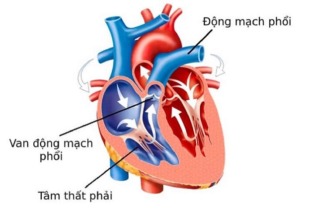 10 bệnh tim ở trẻ sơ sinh thường gặp nhất