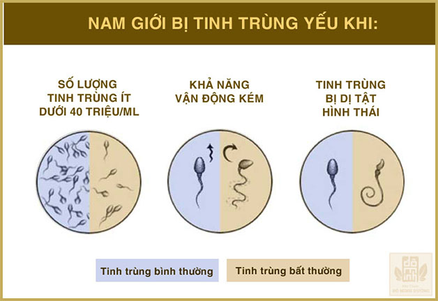 3 nguyên nhân tinh trùng yếu thường gặp nhất ở nam giới