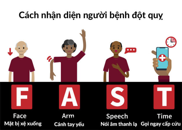 Biểu hiện sớm của bệnh đột quỵ qua quy tắc "Fast"