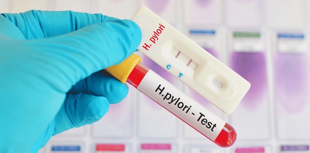 4 phương pháp test vi khuẩn HP phổ biến hiện nay