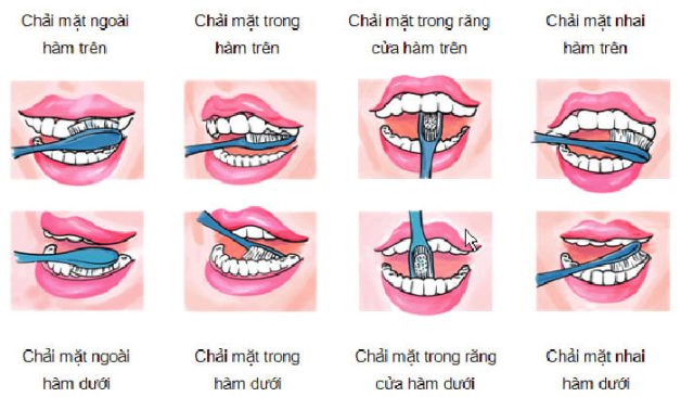 5 cách hạn chế sâu răng hiệu quả từ nha sĩ