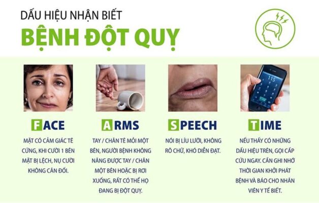 5 Cách nhận biết người bị đột quỵ cần lưu ý