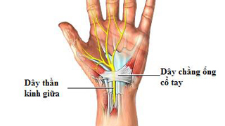 5 nguyên nhân khiến tay bị sưng phù và đau thường gặp