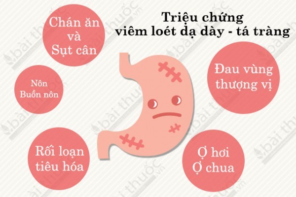 5 triệu chứng viêm loét dạ dày điển hình