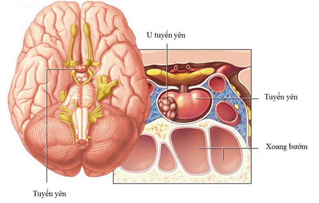 6 bệnh tuyến yên thường gặp mà mọi người cần lưu tâm