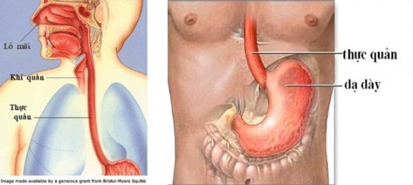 8 dấu hiệu cảnh báo bệnh viêm thực quản trào ngược