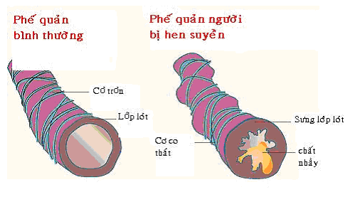 9 bệnh thường gặp vào mùa đông