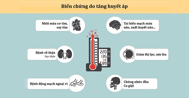 Ai dễ bị đột quỵ - Người mắc bệnh lý tim mạch, tăng huyết áp bị "réo tên"