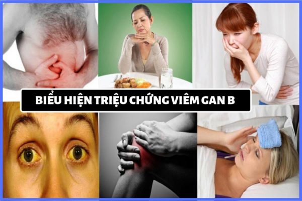 Ai dễ mắc viêm gan B? Bạn hãy đọc để có biện pháp