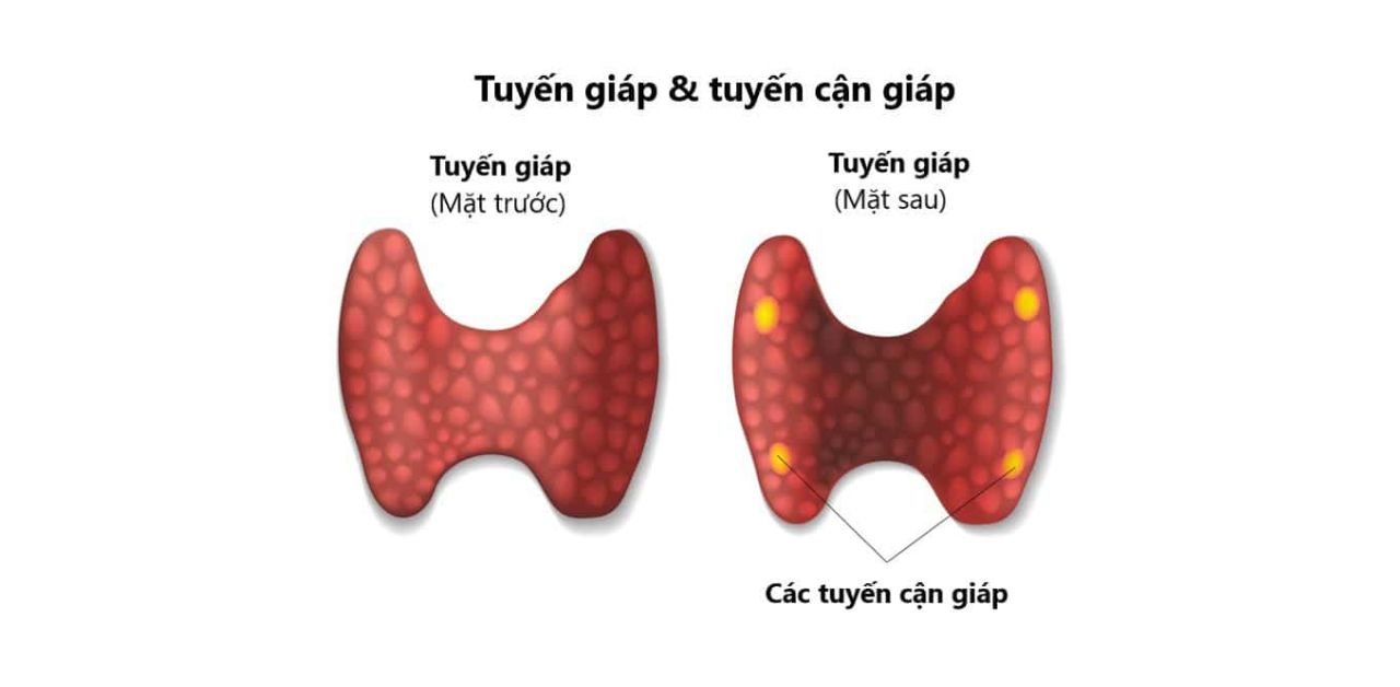 Ảnh hưởng của ưu năng tuyến cận giáp