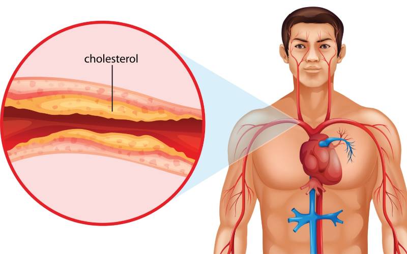 Atorvastatin 10mg – Kiểm soát cholesterol và bảo vệ tim mạch