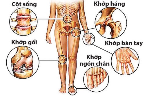 Bác sĩ cơ xương khớp giỏi ở Hà Nội