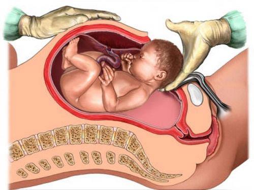 Bác sĩ mổ đẻ chuyên môn cao – lựa chọn an tâm