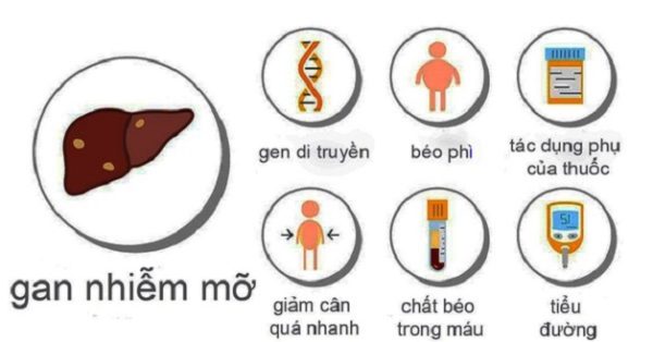 Bạn đã biết gan nhiễm mỡ nên uống gì?