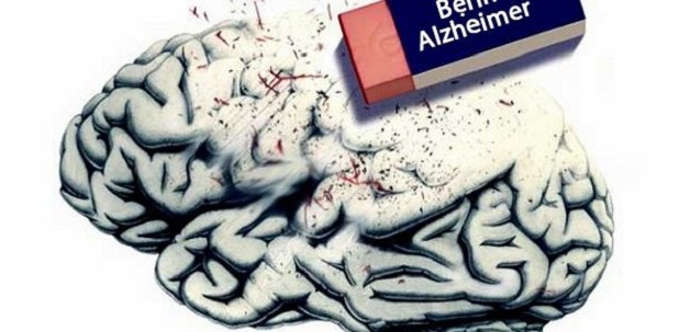 Bệnh alzheimer giai đoạn cuối và cách chăm sóc