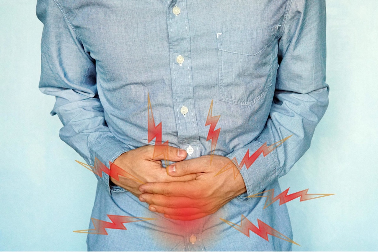 Bệnh Crohn là gì? Cách điều trị và giải pháp phòng bệnh