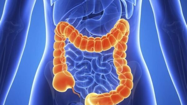 Bệnh Crohn là gì? Nguyên nhân và cách điều trị