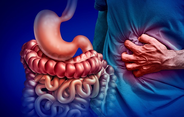 Bệnh Crohn là gì? Nguyên nhân và cách điều trị