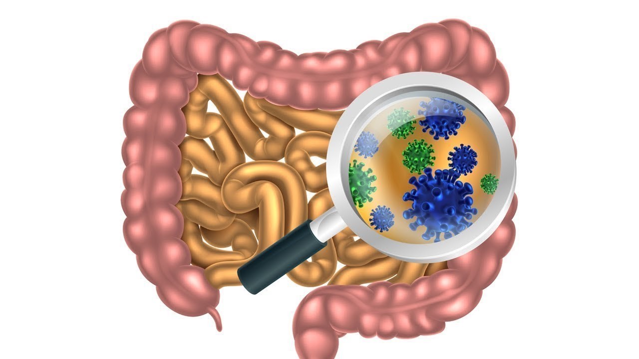 Bệnh crohn là gì? Những kiến thức cần cần biết