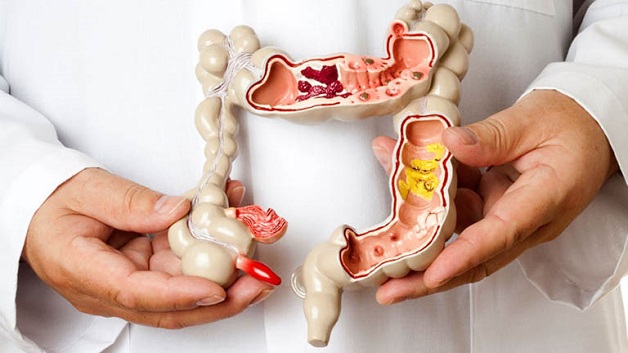 Bệnh Crohn ở trẻ em: nguyên nhân, triệu chứng và cách chữa trị 