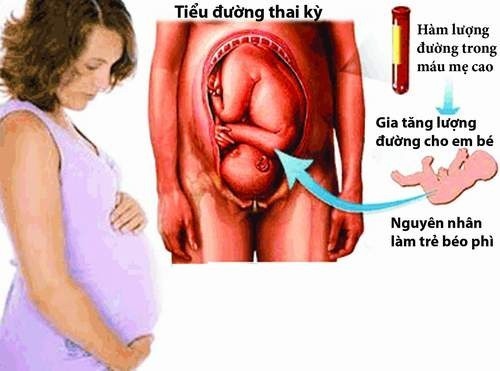 Bệnh đái tháo đường có di truyền không?