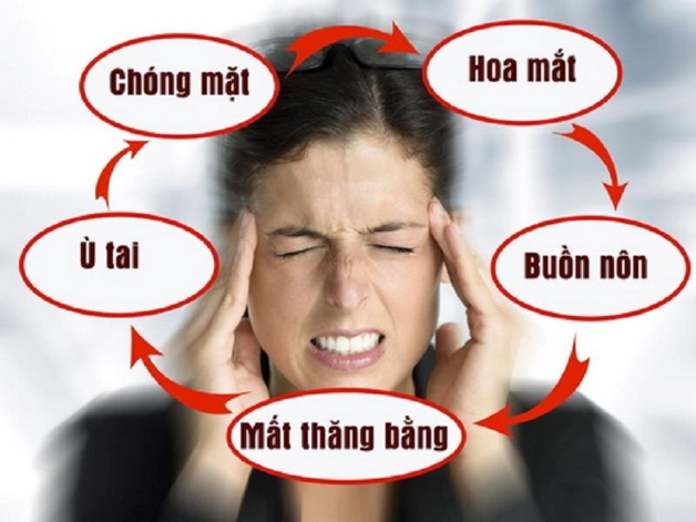 Bệnh đau đầu rối loạn tiền đình có nguy hiểm không, điều trị thế nào?