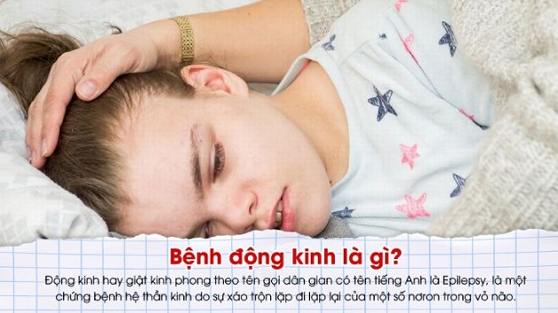 Bệnh động kinh hiểu đúng, điều trị hiệu quả