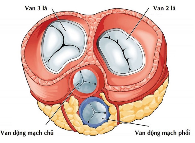 Bệnh hẹp van tim là gì, có điều trị được không?