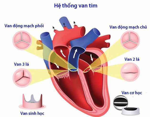 Bệnh hở van tim 3 lá có chữa được không?