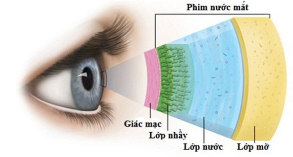 Bệnh khô mắt có chữa khỏi không?