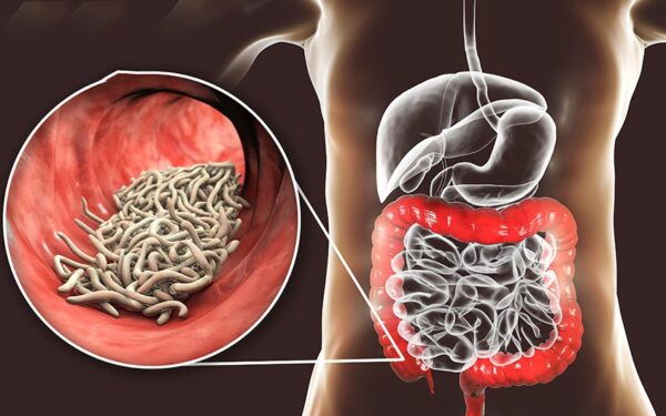 Bệnh kiết lỵ có nguy hiểm không và cách phòng bệnh