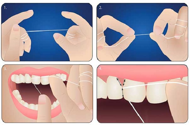 Bệnh loét niêm mạc miệng: những điều cần biết