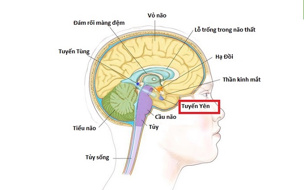 Bệnh lùn tuyến yên và biểu hiện cần biết