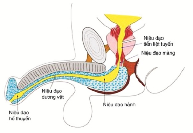 Bệnh lý sỏi niệu đạo trước và sau ở nam giới