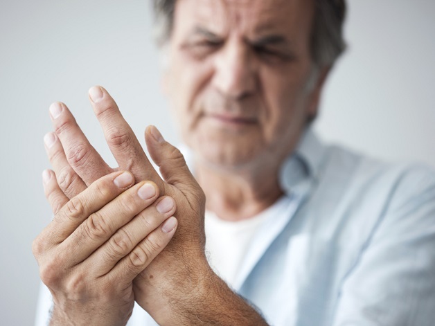 Bệnh Parkinson có nguy hiểm không? Triệu chứng của bệnh