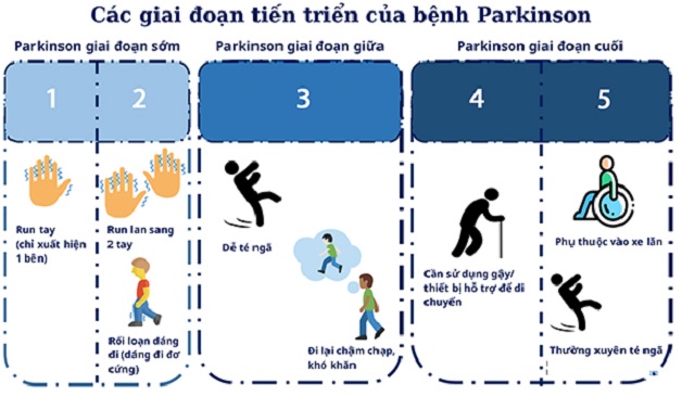 Bệnh Parkinson giai đoạn cuối có biểu hiện gì?