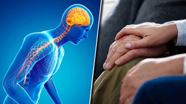 Bệnh parkinson giai đoạn cuối dễ bị té ngã và cách khắc phục