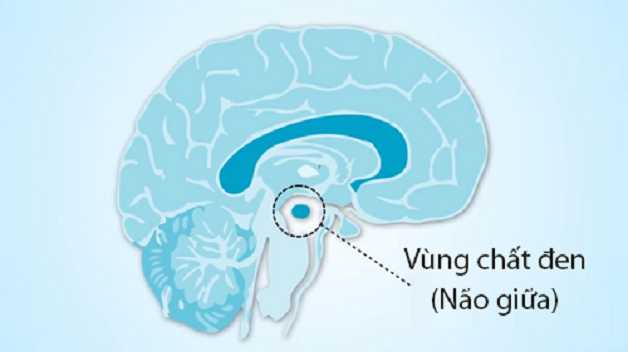 Bệnh Parkinson run tay chân có chữa được không?