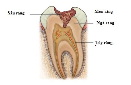 Bệnh răng miệng người bệnh khó chịu, giảm chất lượng