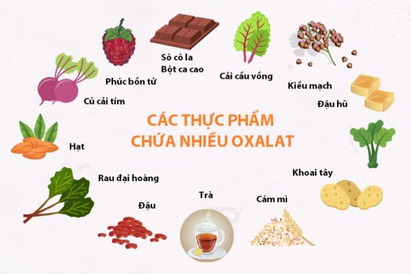 Bệnh sỏi bàng quang kiêng gì để nhanh khỏi?