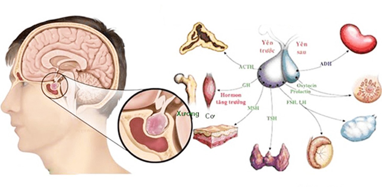 Bệnh suy tuyến yên và những điều cần biết