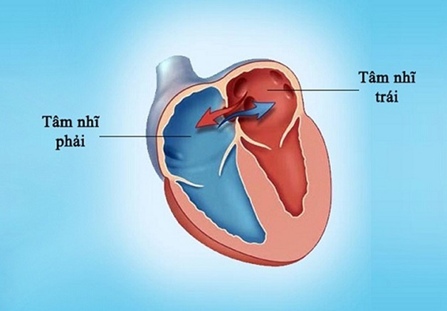 Bệnh thông liên nhĩ có nguy hiểm không?