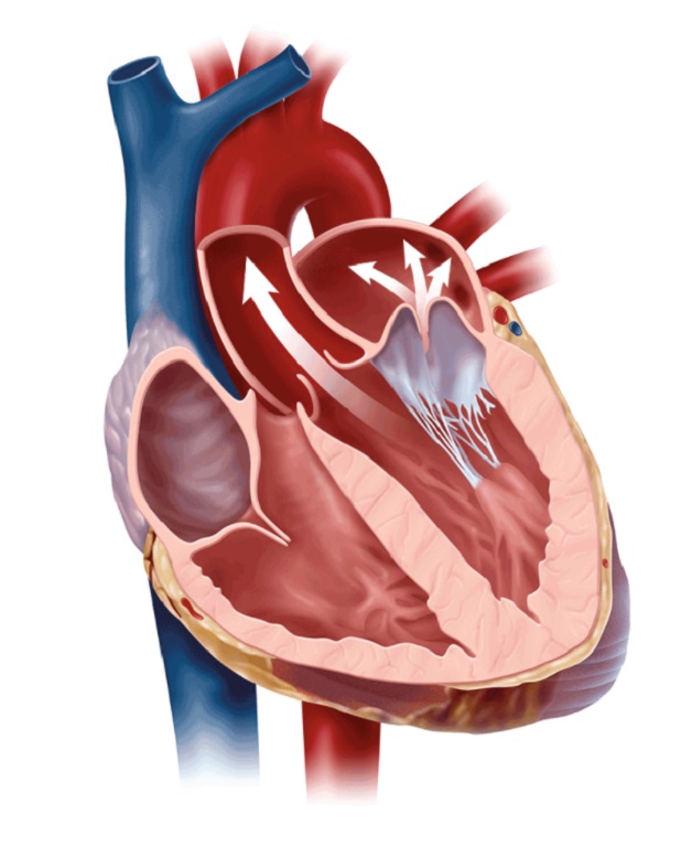 Bệnh tim hở van 2 lá: Những biến chứng nguy hiểm