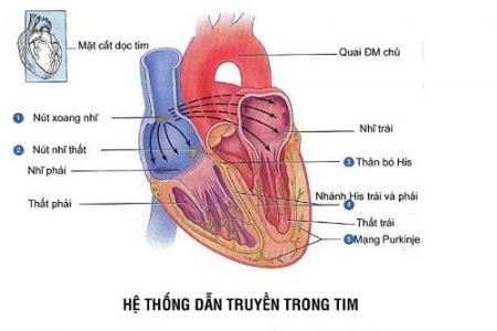 Bệnh tim thông liên nhĩ bệnh thường gặp nhất